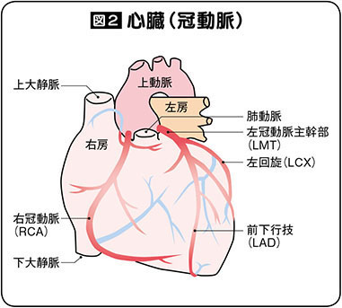 心臓（冠動脈）