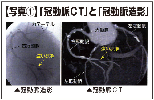 CTと造影画像