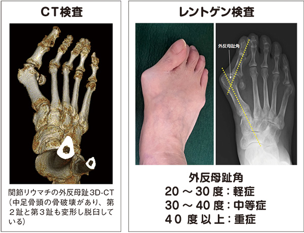 CT検査、レントゲン検査