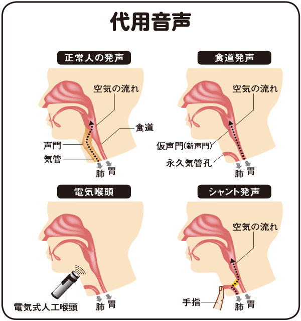 代用音声